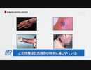 中国で10年ぶりに炭疽菌による死者