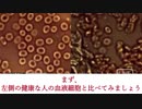 ワクチン接種後の血液変化を顕微鏡で見た！ ジェーン・ルビー医師説明