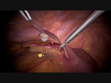 臓器レ〇プ！天才外科医と化した先輩.vr