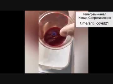 【コロナワクチン】ワクチン接種者の血液の状態