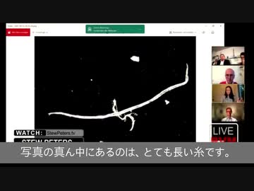 コロナワクチン には無数の金属片と謎の虫が入っていたようです。