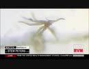 キャリー・マデイ博士、コロナワクチンに含まれる異物を発見