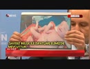 トルコ 接種によって変形した赤ちゃんの画像を公開