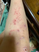 不都合起きてる　ワクチン無料、ワクチン被害治療費は自己負担