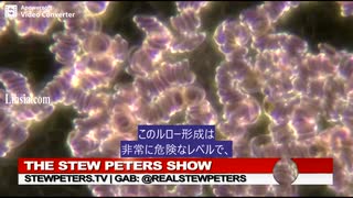 接種者の赤血球が変異する事例が多発