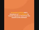 Amyotrophic lateral sclerosis_ Signs and Symptoms