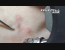 【ASMR】蚊に刺された足首を耳かきで掻く音_I got a mosquito bite_TASCAM DR-07MK2_no talking