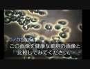 衝撃映像！　ワクチン接種前後の血液の変化
