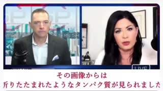 接種者が臭う・臭いと言われる理由