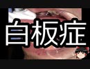【ゆっくり朗読】ゆっくりさんと不思議な病気 その444