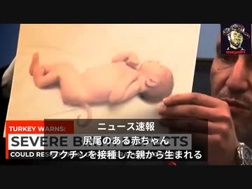 ワクチン接種後の妊婦から生まれた奇形の赤ちゃん