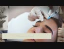 Anti Wrinkle Injections
