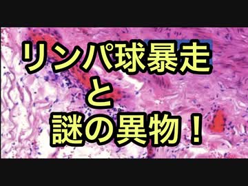 遺体解剖して分かったワクチン接種後のリンパ球暴走、ワクチン液内の得体のしれない異物！