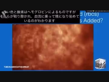 ワクチンを血液に入れたら1〜2分で血液が凝固しはじめる