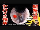 【閲覧注意ASMR】イヤースコープ本物耳かき音 耳の奥にヤバすぎ物体発見！Real Ear Cleaning Sound /SONY ECM-CS3 /no talking
