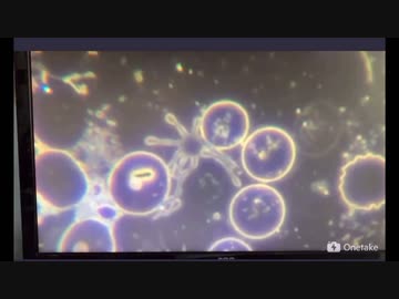 ワクチン接種後の血液中でうごめく物体