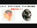 #国体崩壊#殺人プリオンワクチン　これって　きちやってるよね　プリオン第2次症状　#言葉が出にくく　#最近転びやすく　#物忘れ