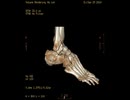 BONE CRASH