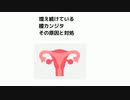 #膣カンジタ　増え続けている膣カンジタ　 その原因と対処