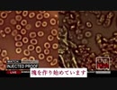 mRNAワクチン接種者の赤血球が破壊され絶滅している証拠映像