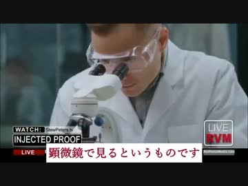 mRNAワクチン接種者の赤血球が破壊されている