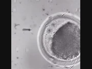 ホモと見る　ナノボットが精子を運んで卵子に受精させる映像