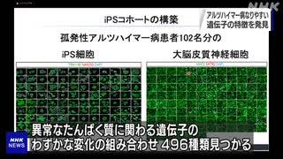 アルツハイマー病になりやすい遺伝子の特徴特定 京大iPS研など