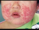治験ワクチン接種を大切な自分の子供に考えて居る方へ