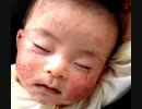 コロナワクチンと超過死亡