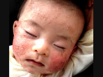 コロナワクチンと超過死亡