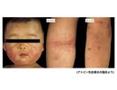 子供に害悪のコロナワクチン