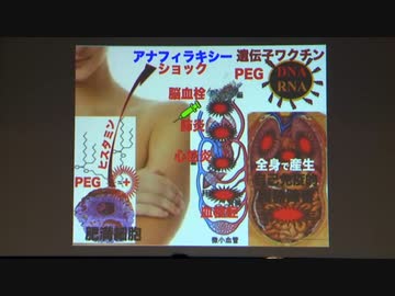 ５類にすれば即日成仏　　井上正康先生