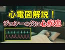 【ＦＦ７リメイク】ジェシーの父の心電図解説！【ちゃんすけ切り抜き】
