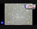 “iPS由来の細胞” 脊髄損傷患者への移植「安全性問題なし」