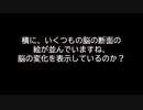 人間の視神経からの映像