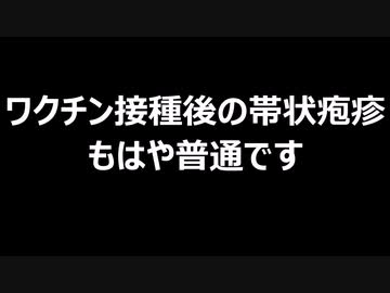 ワクチン接種後の帯状疱疹　もはや普通です