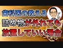 詰め物が外れても放置していい場合を歯科医が解説