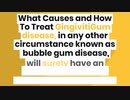 What Causes and How To Treat Gingivitis
