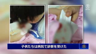 河南省で児童100人に鼻血の症状