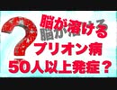 ワクチン接種で脳が溶けるプリオン病？ヨーロッパで50人以上発症