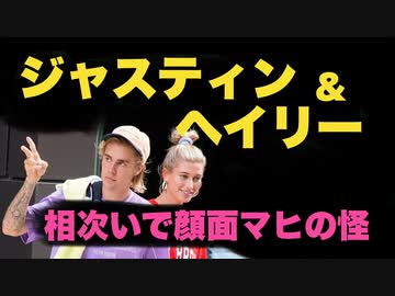 ジャスティン・ビーバー夫妻が次々顔面マヒの怪【3月に妻、6月に本人】副反応か？