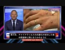 米国CDCは「空気感染しないサル痘」に「マスク」を推奨し始めました