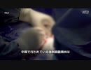 台湾の病院が医師２名を解雇、中国本土で臓器狩りの移植手術に加担した為