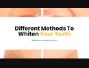 Different Methods To Whiten Your Teeth What You Need To Know