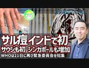 【サル痘】ニュース、インドとサウジで初の確定例【インド、サウジアラビア、シンガポール、WHO、グローバルヘルスの動向、天然痘、健康、猿とうウイルス】