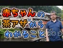 赤ちゃんの茶アザからわかることとその意味 #内海聡 #うつみん 【世界一嫌われ医者】