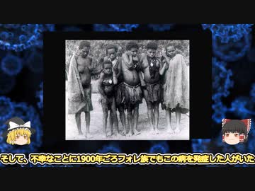 人気の クールー病 動画 4本 ニコニコ動画