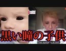 【Viviane Brunet】ヴィヴィアン・ブルネット医師より「黒い瞳の赤ちゃん」について。