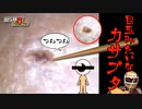 カラー版 【瘡蓋ASMR】目玉みたいな痒い瘡蓋を爪楊枝で強めにゴリゴリ剥す音 /SONY ECM-PC60/イヤースコープ/癒し/リラックス効果/カサブタ掻き【SMダークネス】