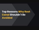 Top Reasons Why Root Canal Shouldn’t Be Avoided